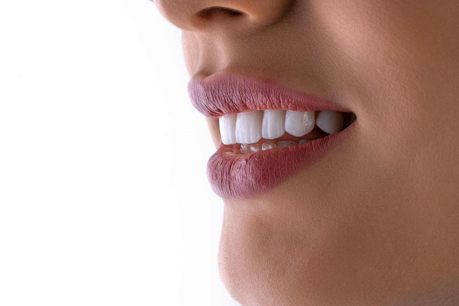 Sonrisa blanca y armoniosa lograda con estética dental